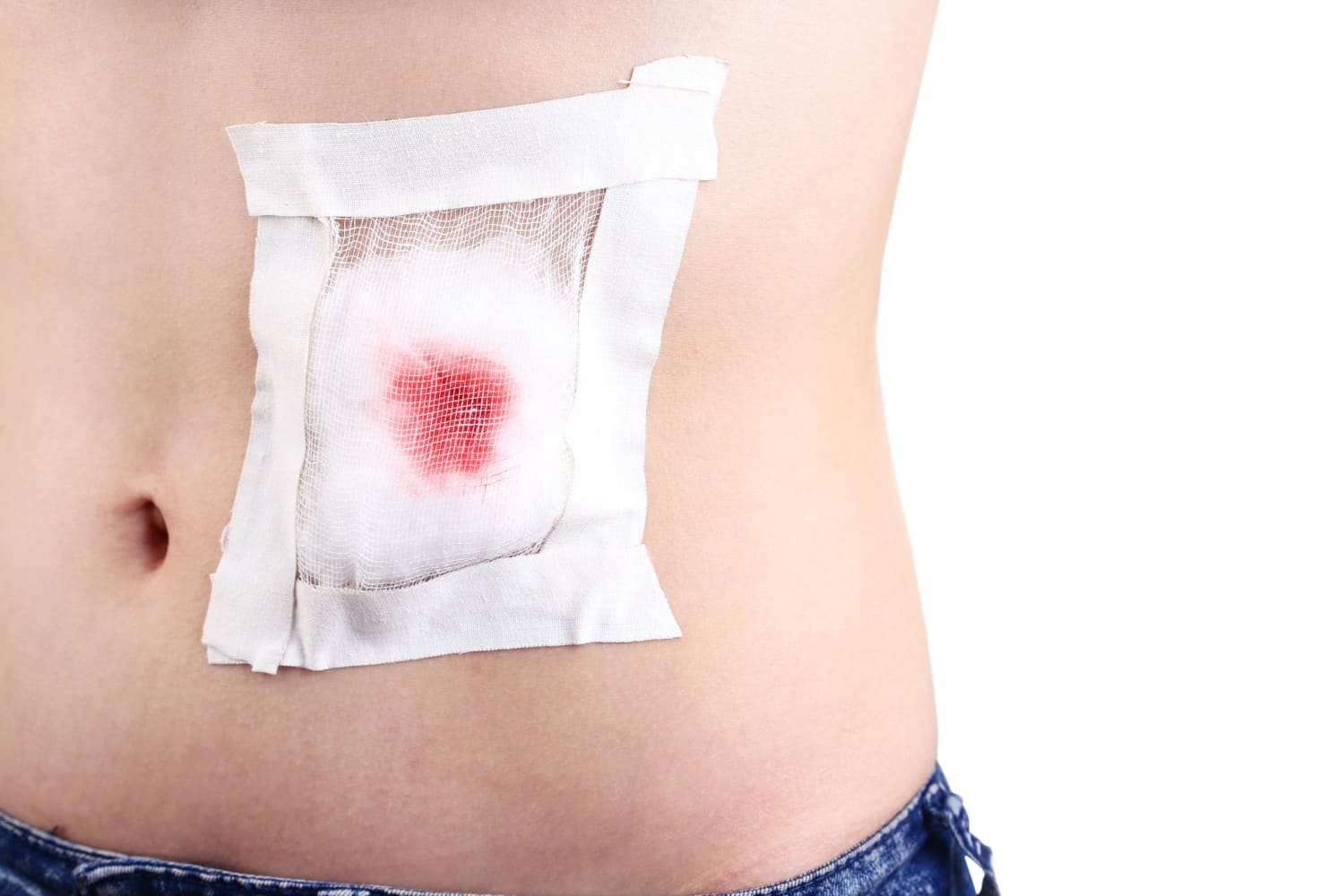 Tratamiento de abdomen agudo en Tijuana con el Dr. Mario Alberto Arredondo Ortiz